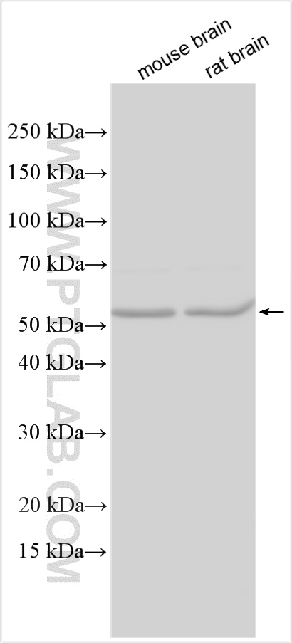 Western Blot (WB) analysis of various lysates using MMP24 Polyclonal antibody (30102-1-AP)