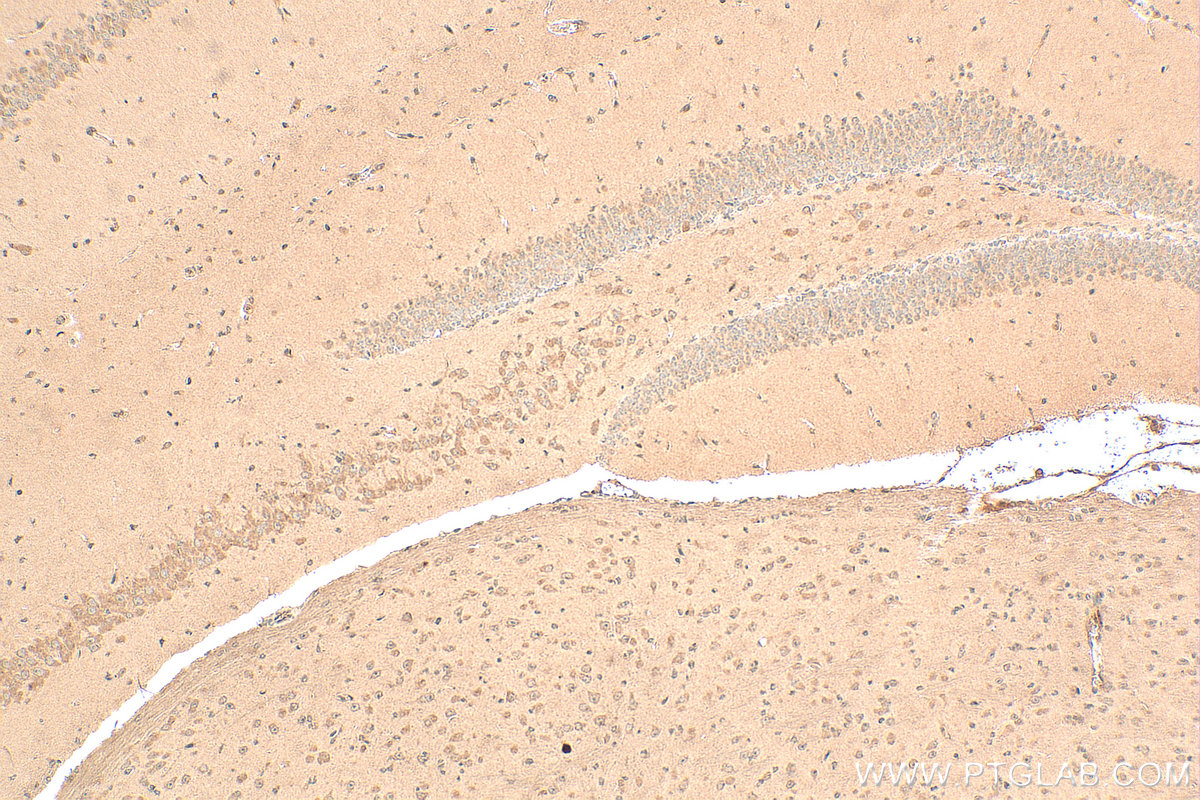Immunohistochemistry (IHC) staining of mouse brain tissue using MMP3 Polyclonal antibody (17873-1-AP)