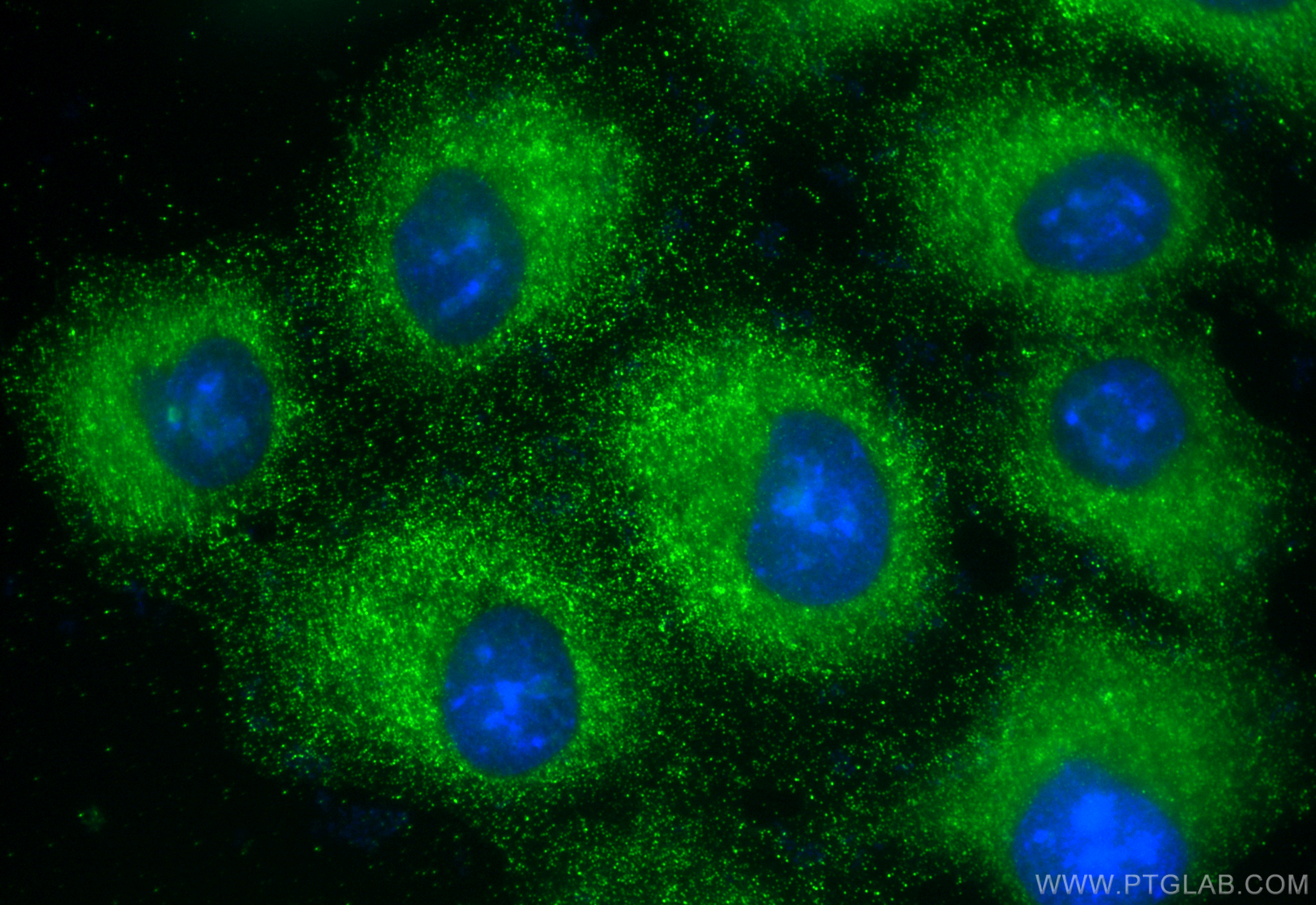 Immunofluorescence (IF) / fluorescent staining of A549 cells using MMP3 Monoclonal antibody (66338-1-Ig)