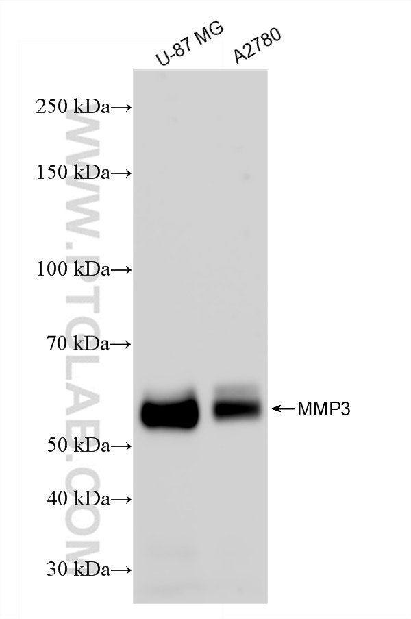 Western Blot (WB) analysis of various lysates using MMP3 Recombinant antibody (82984-4-RR)