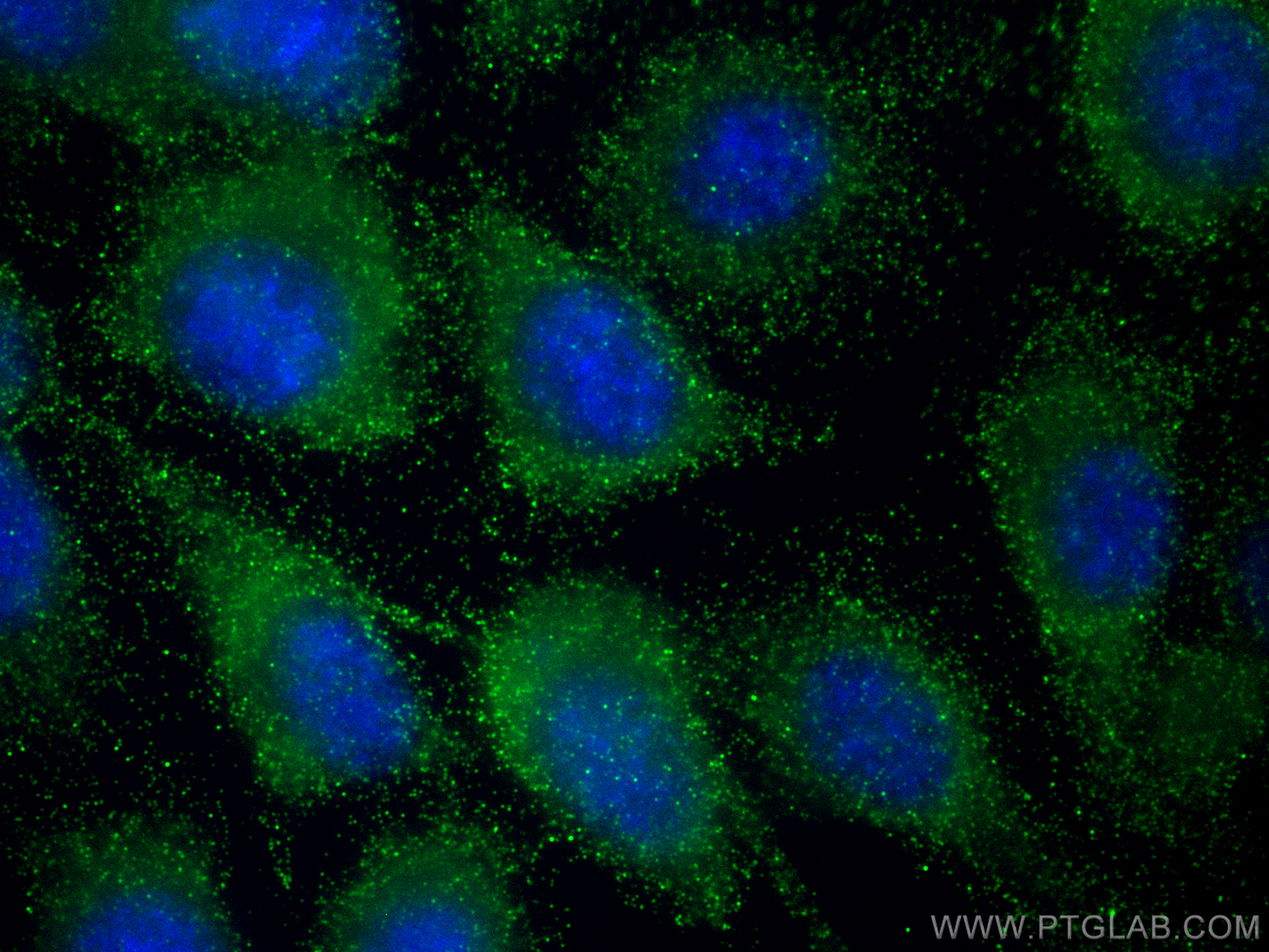 Immunofluorescence (IF) / fluorescent staining of PC-3 cells using MMP7 Monoclonal antibody (67990-1-Ig)