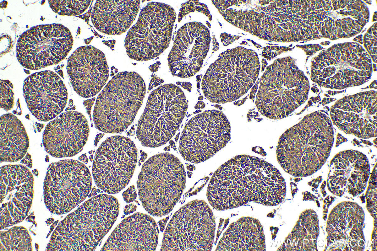 Immunohistochemistry (IHC) staining of mouse testis tissue using MMS19 Monoclonal antibody (66049-1-Ig)