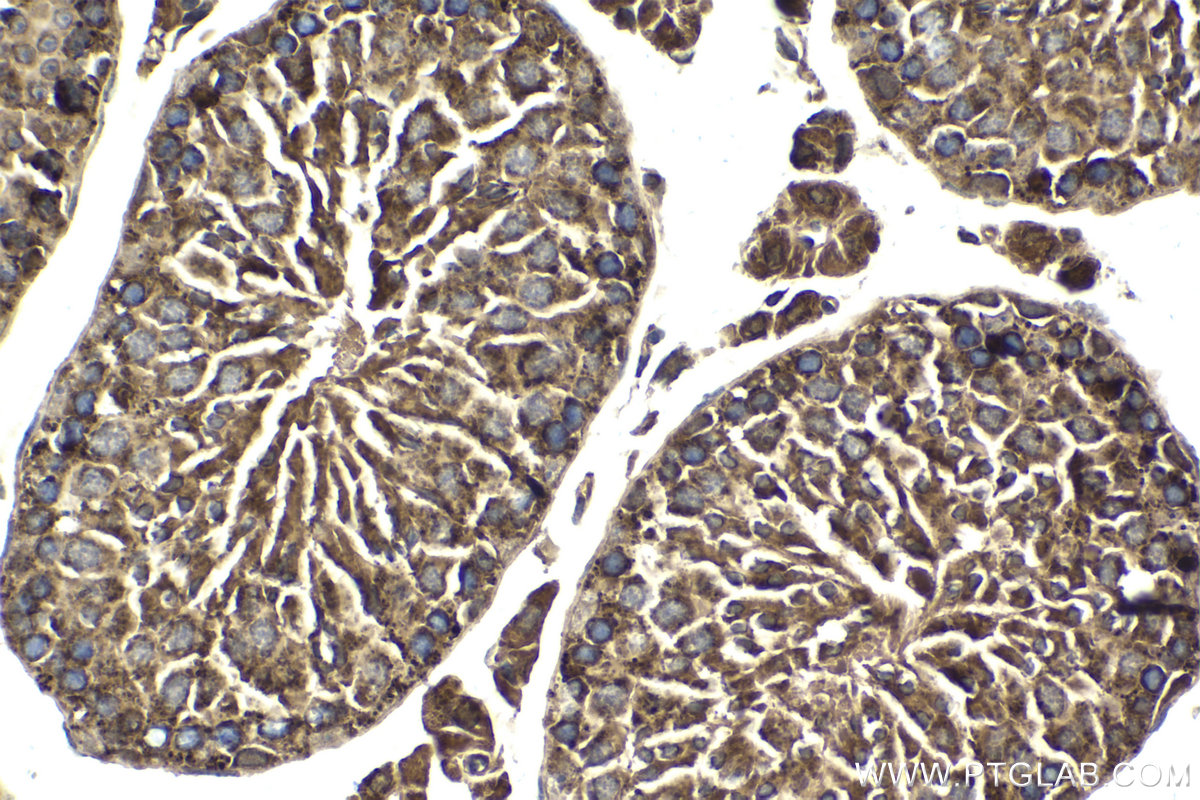 Immunohistochemistry (IHC) staining of mouse testis tissue using MMS19 Monoclonal antibody (66049-1-Ig)