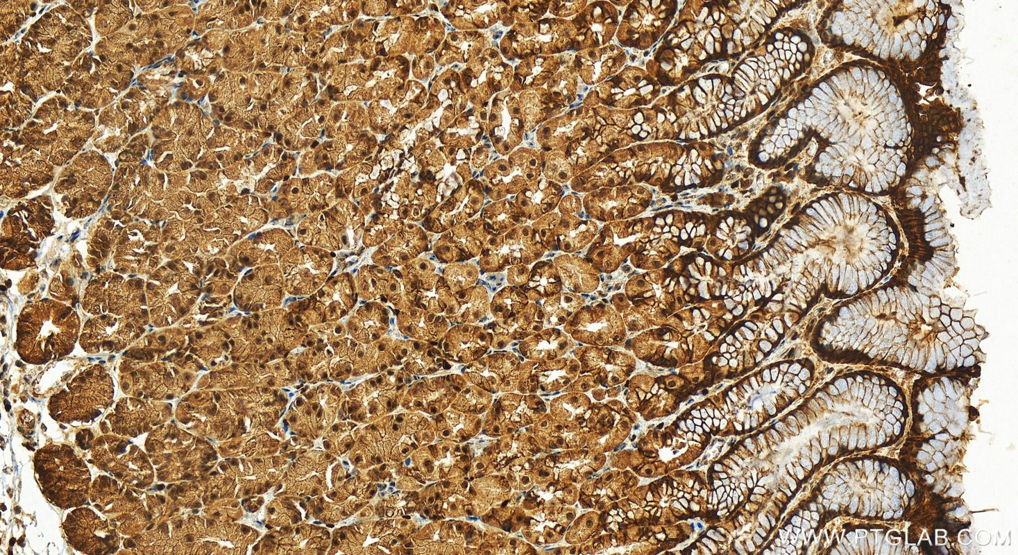 Immunohistochemistry (IHC) staining of human stomach tissue using MNDA Polyclonal antibody (13576-1-AP)