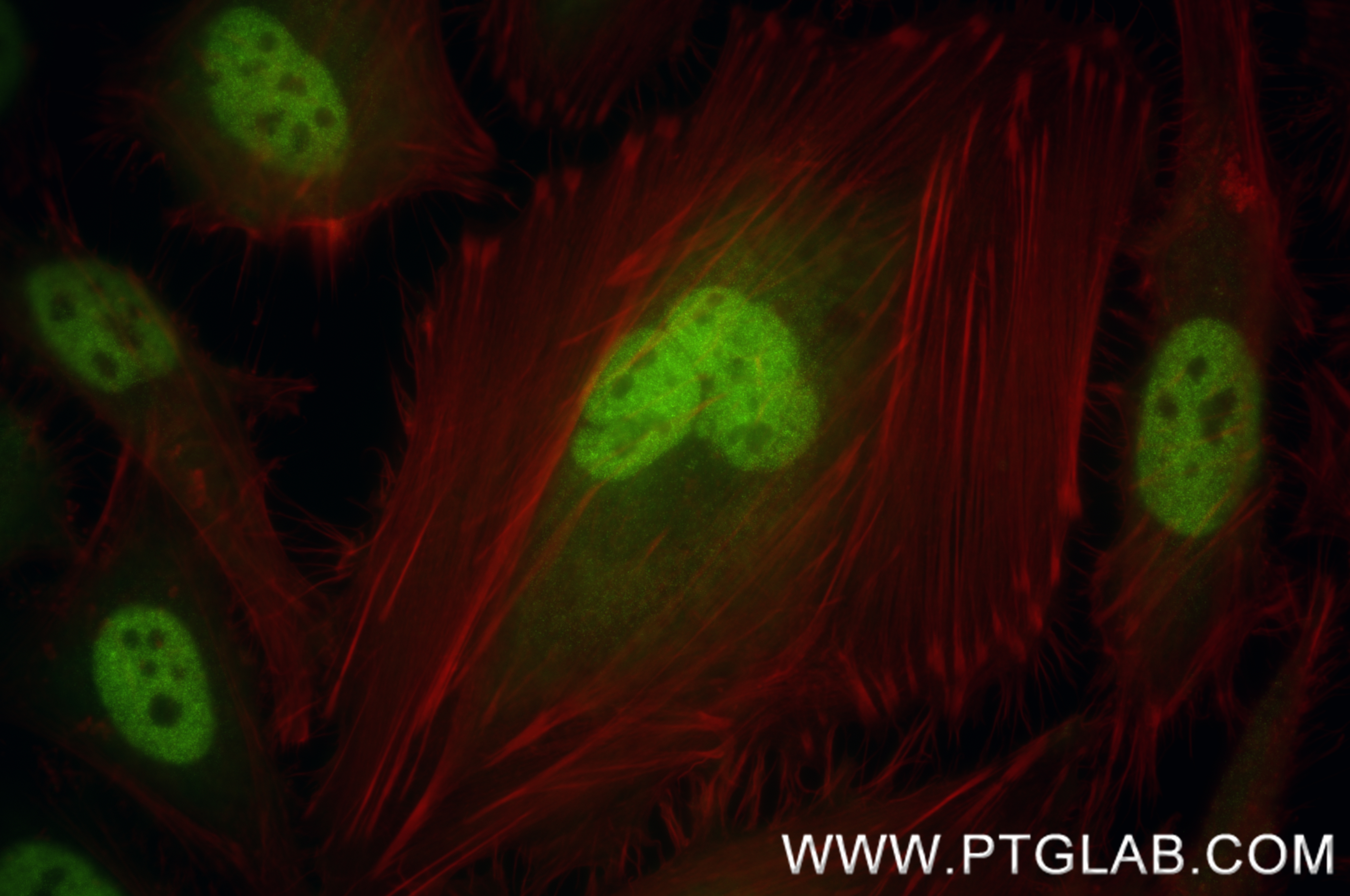 Immunofluorescence (IF) / fluorescent staining of HeLa cells using MNT Recombinant antibody (83648-1-RR)