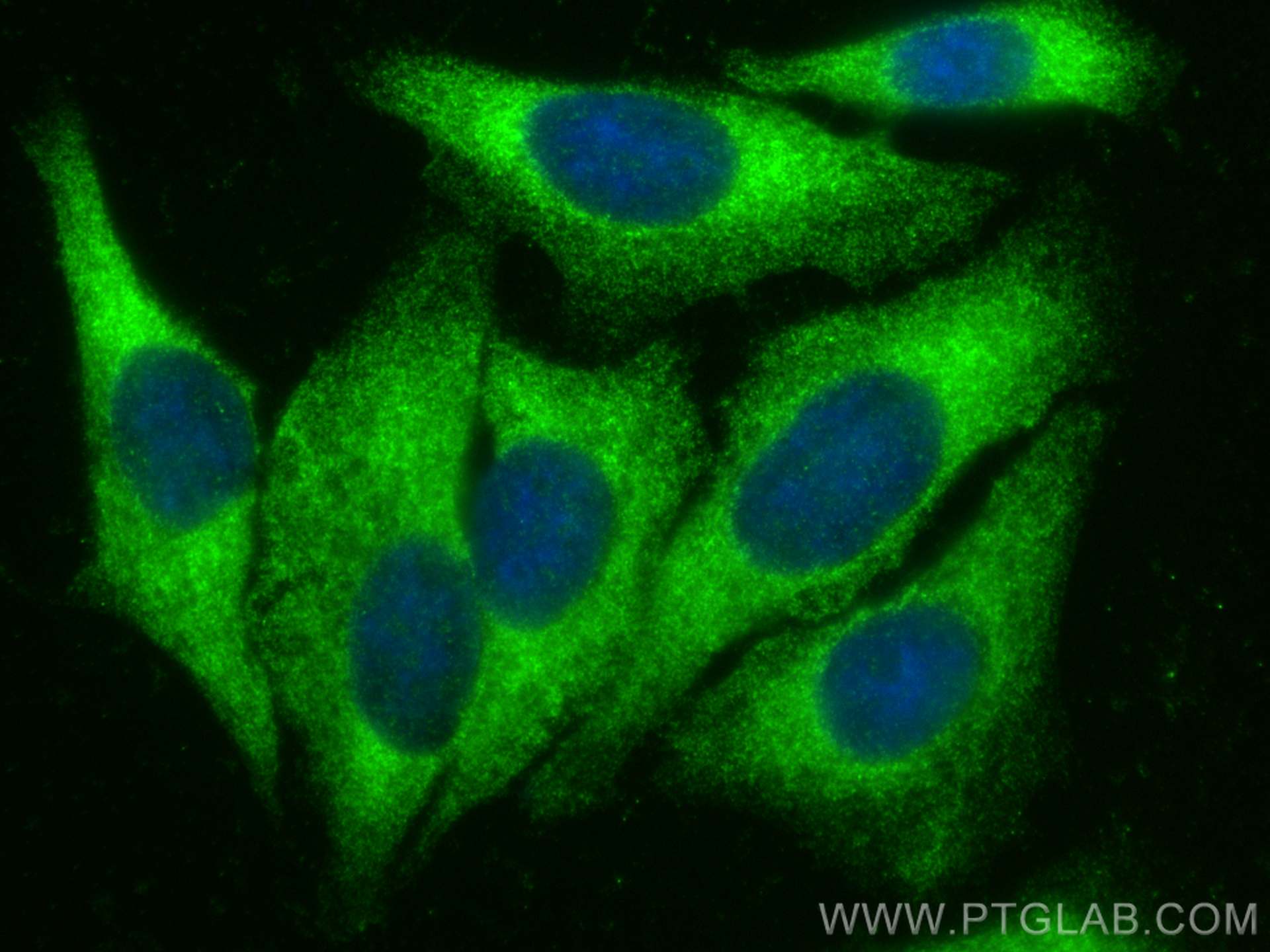 Immunofluorescence (IF) / fluorescent staining of HepG2 cells using MOCOS Polyclonal antibody (16395-1-AP)