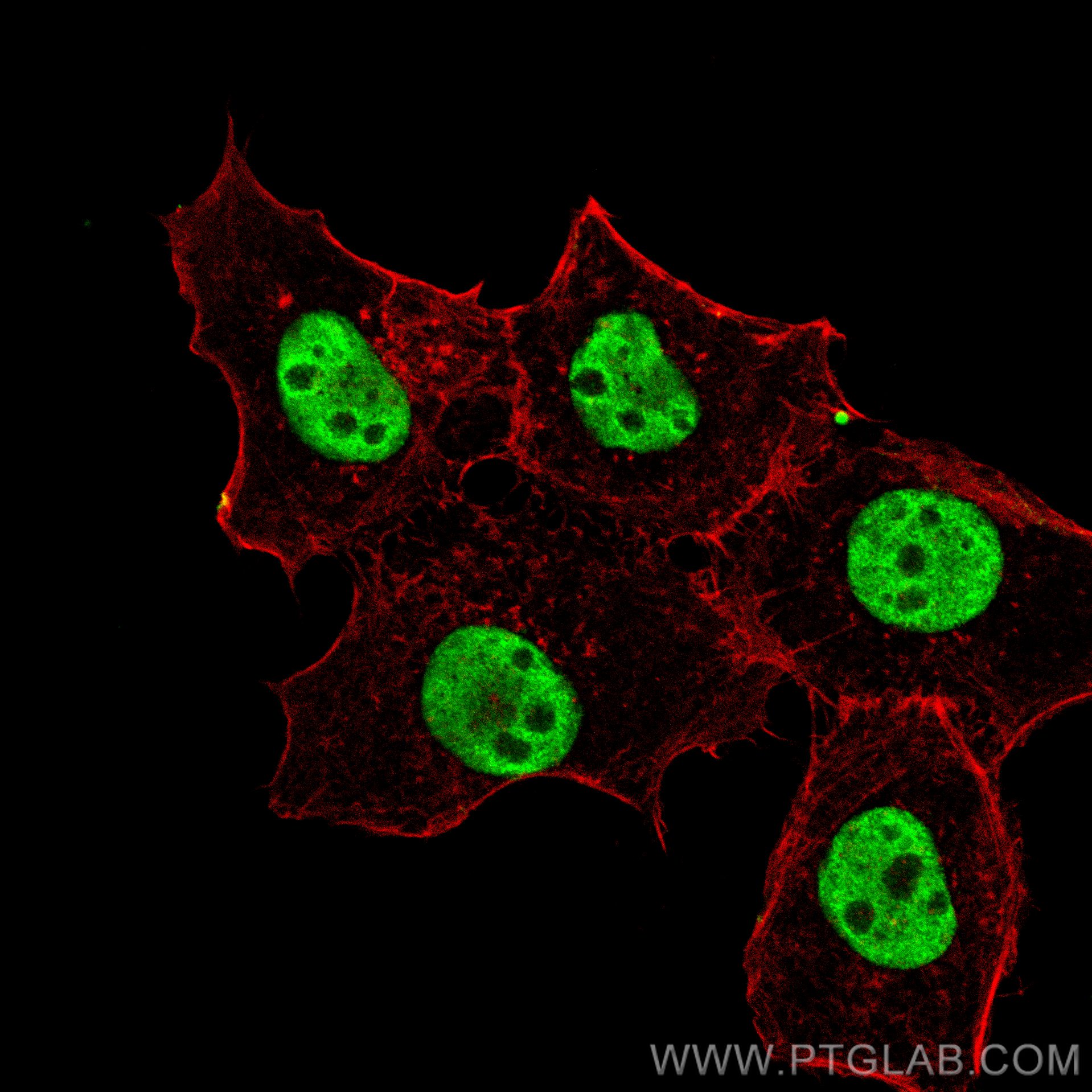 Immunofluorescence (IF) / fluorescent staining of A431 cells using MORC3 Polyclonal antibody (24994-1-AP)