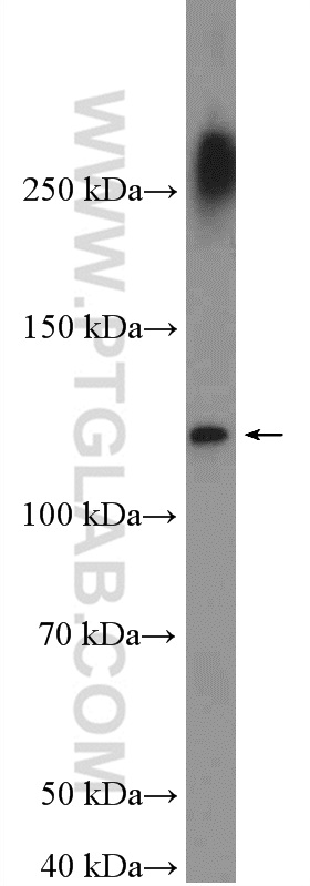 Western Blot (WB) analysis of HeLa cells using MORC3 Polyclonal antibody (24994-1-AP)