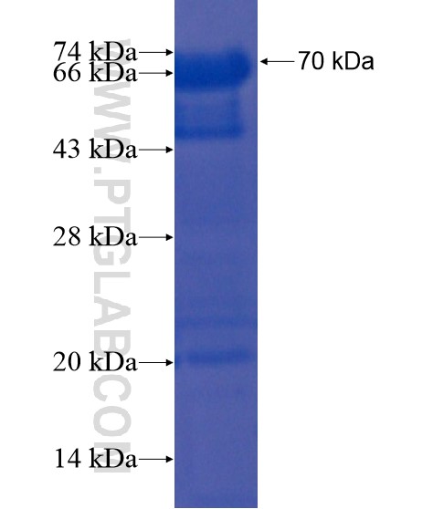 MORC3 fusion protein Ag21825 SDS-PAGE