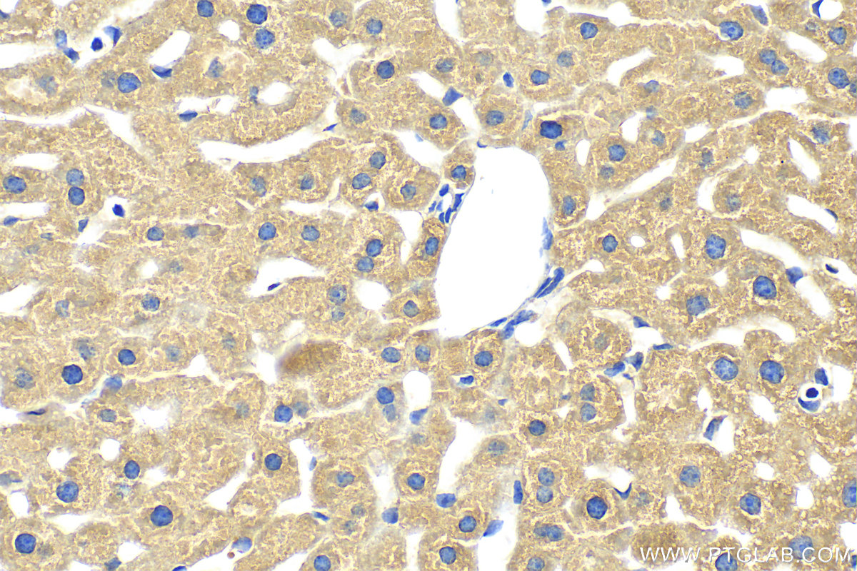 Immunohistochemistry (IHC) staining of mouse liver tissue using MOSC2 Polyclonal antibody (24782-1-AP)