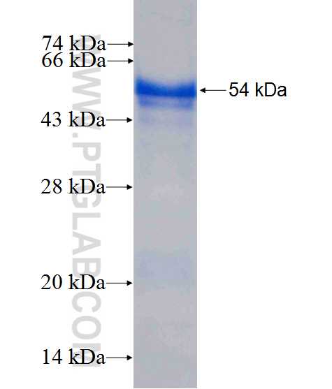 MPHOSPH8 fusion protein Ag10258 SDS-PAGE