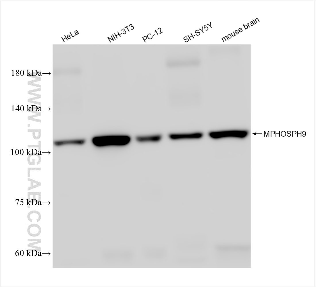 Western Blot (WB) analysis of various lysates using MPHOSPH9 Recombinant antibody (83397-5-RR)