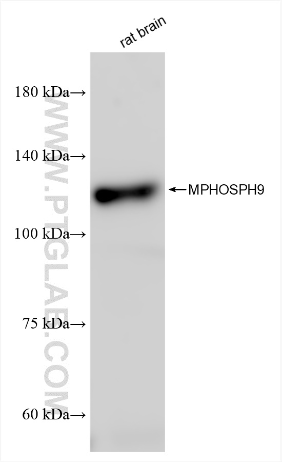 Western Blot (WB) analysis of various lysates using MPHOSPH9 Recombinant antibody (83397-5-RR)