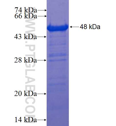 MPHOSPH9 fusion protein Ag22401 SDS-PAGE