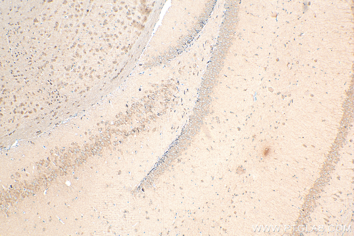 Immunohistochemistry (IHC) staining of mouse brain tissue using MPI Monoclonal antibody (68417-1-Ig)