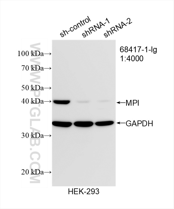 Western Blot (WB) analysis of HEK-293 cells using MPI Monoclonal antibody (68417-1-Ig)