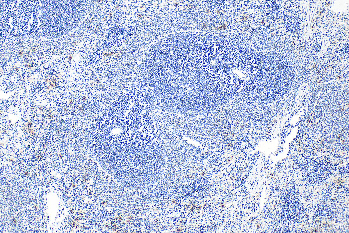 Immunohistochemistry (IHC) staining of rat spleen tissue using MPO Polyclonal antibody (22225-1-AP)