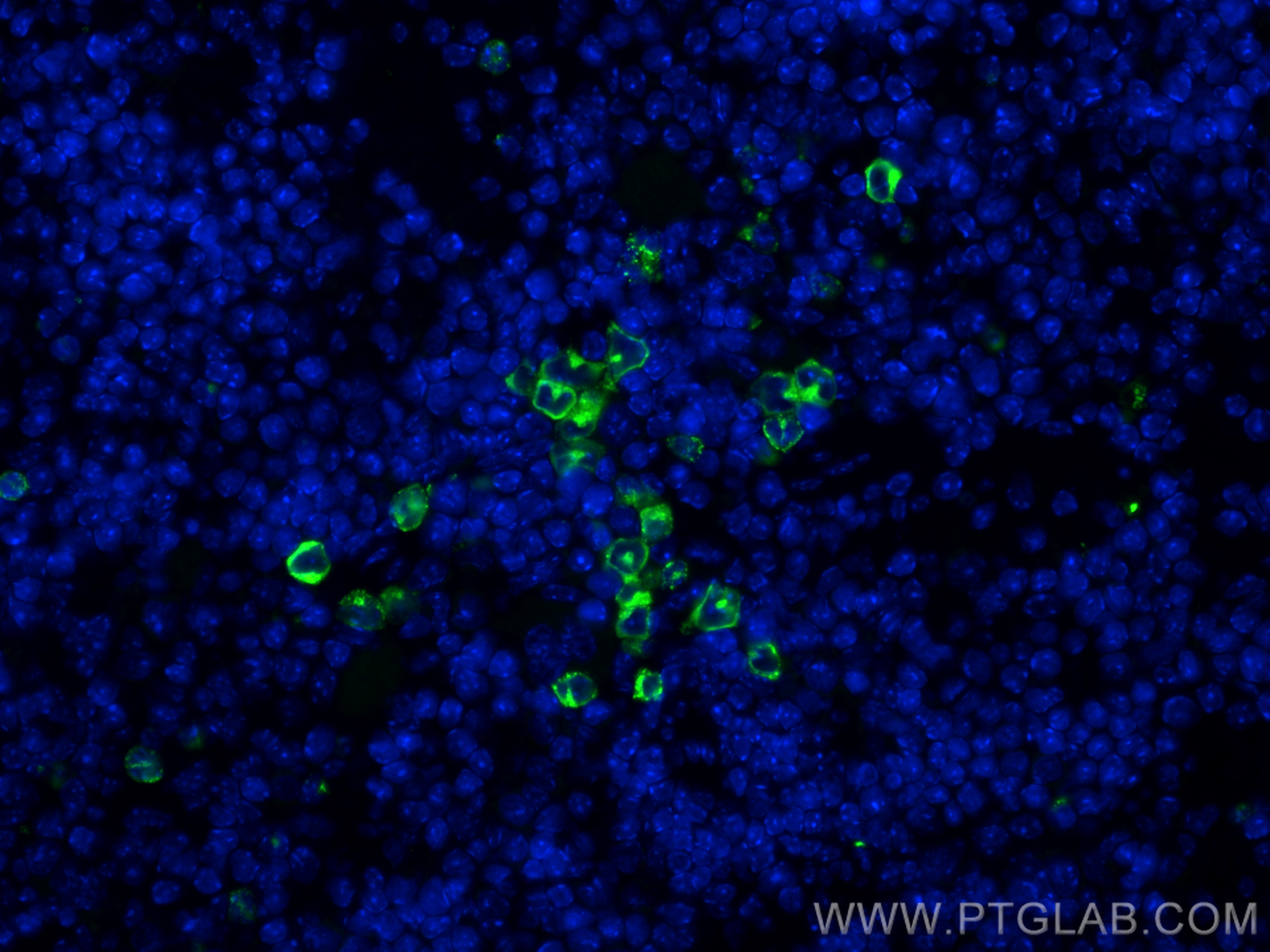 Immunofluorescence (IF) / fluorescent staining of mouse spleen tissue using MPO Polyclonal antibody (32385-1-AP)