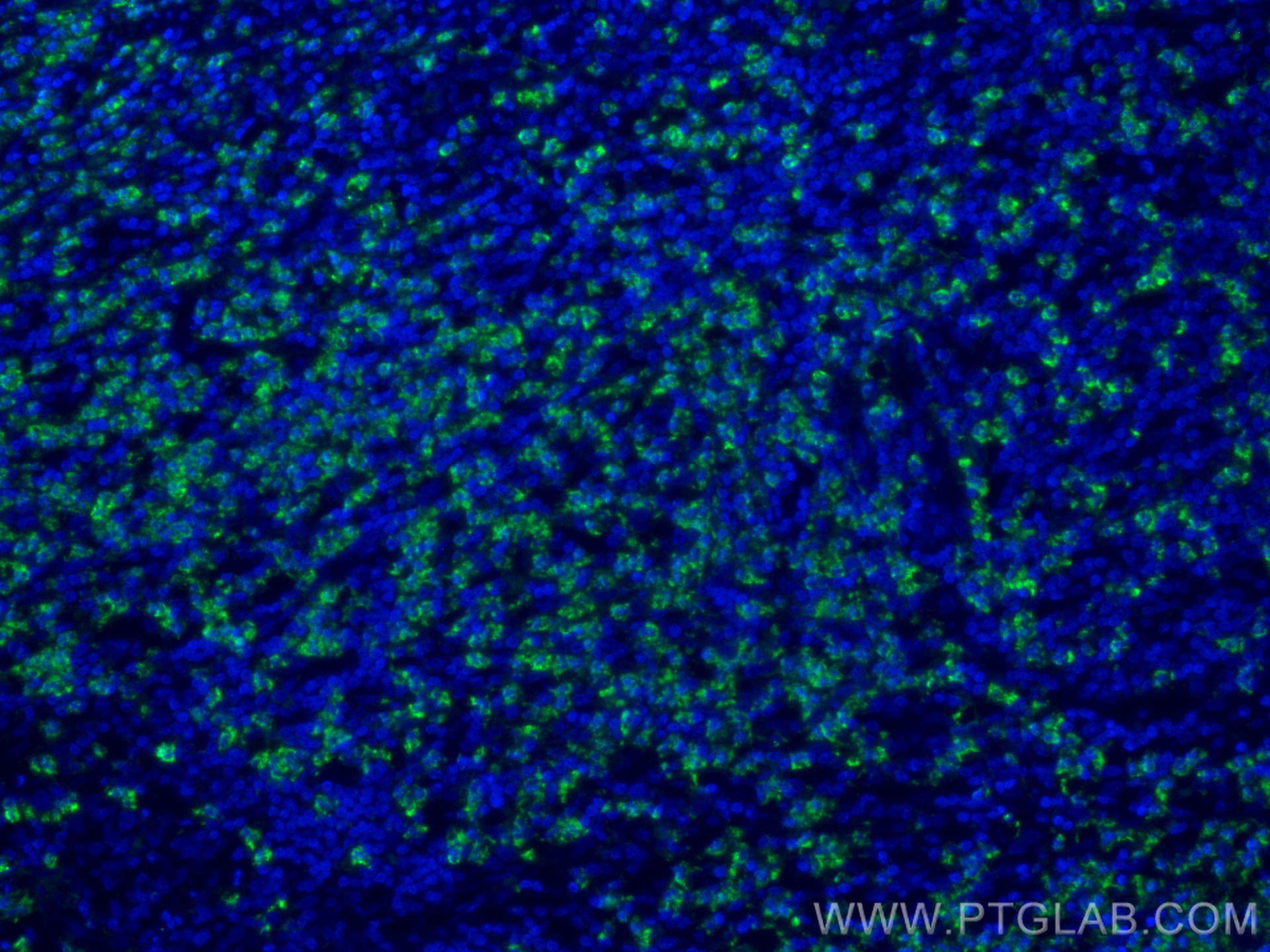 Immunofluorescence (IF) / fluorescent staining of human appendicitis tissue using MPO Monoclonal antibody (66177-1-Ig)