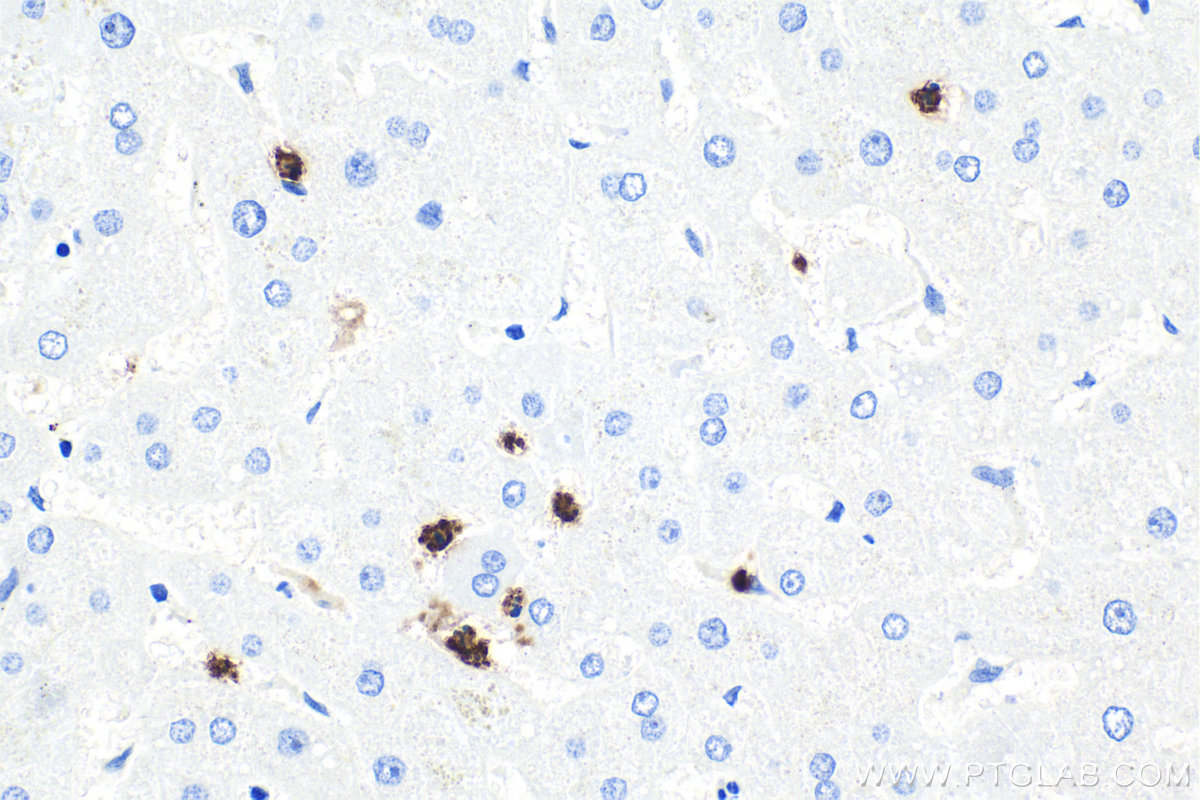 Immunohistochemistry (IHC) staining of human liver tissue using MPO Monoclonal antibody (66177-1-Ig)