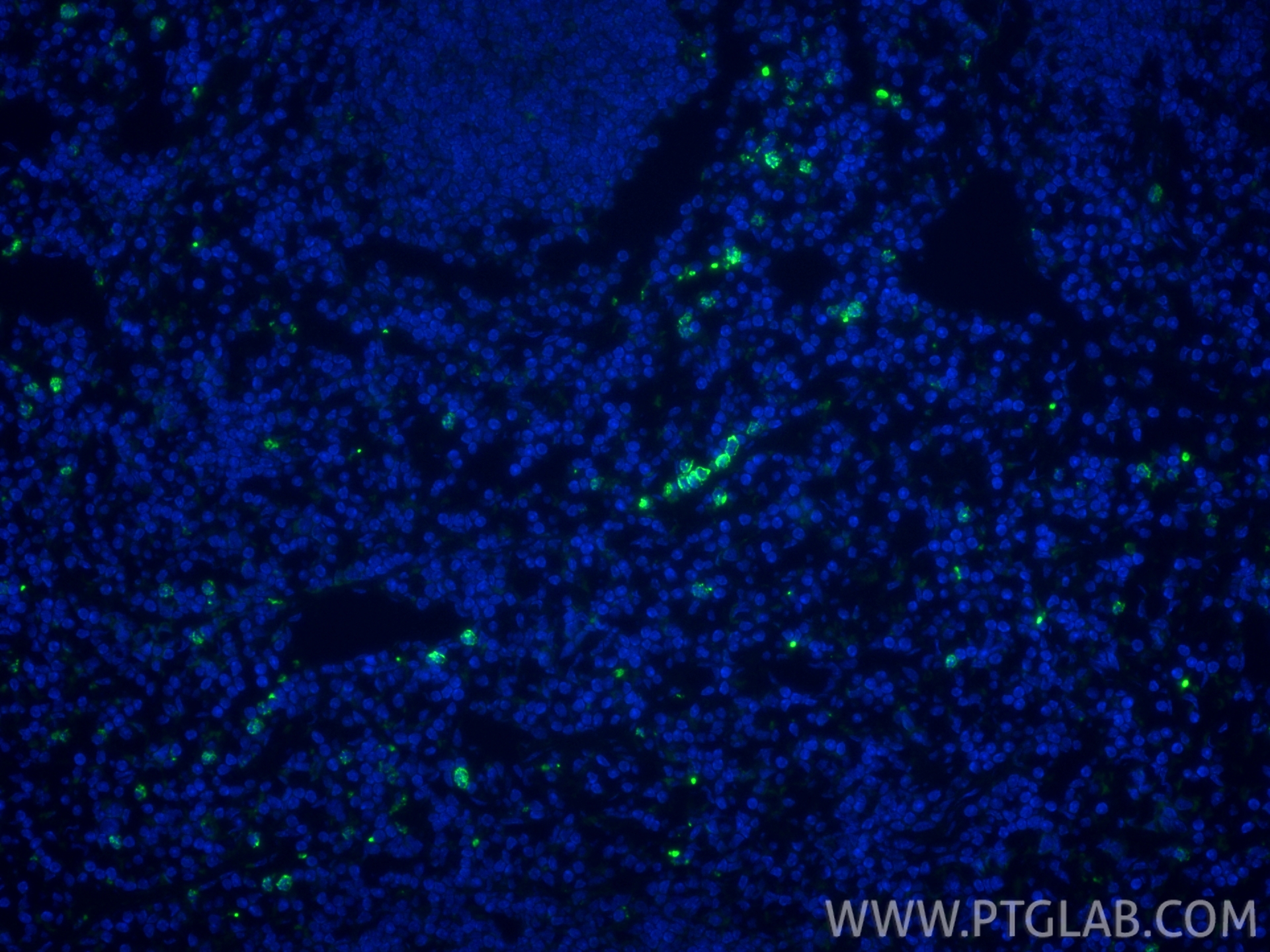 Immunofluorescence (IF) / fluorescent staining of mouse spleen tissue using Biotin-conjugated MPO Polyclonal antibody (Biotin-22225)