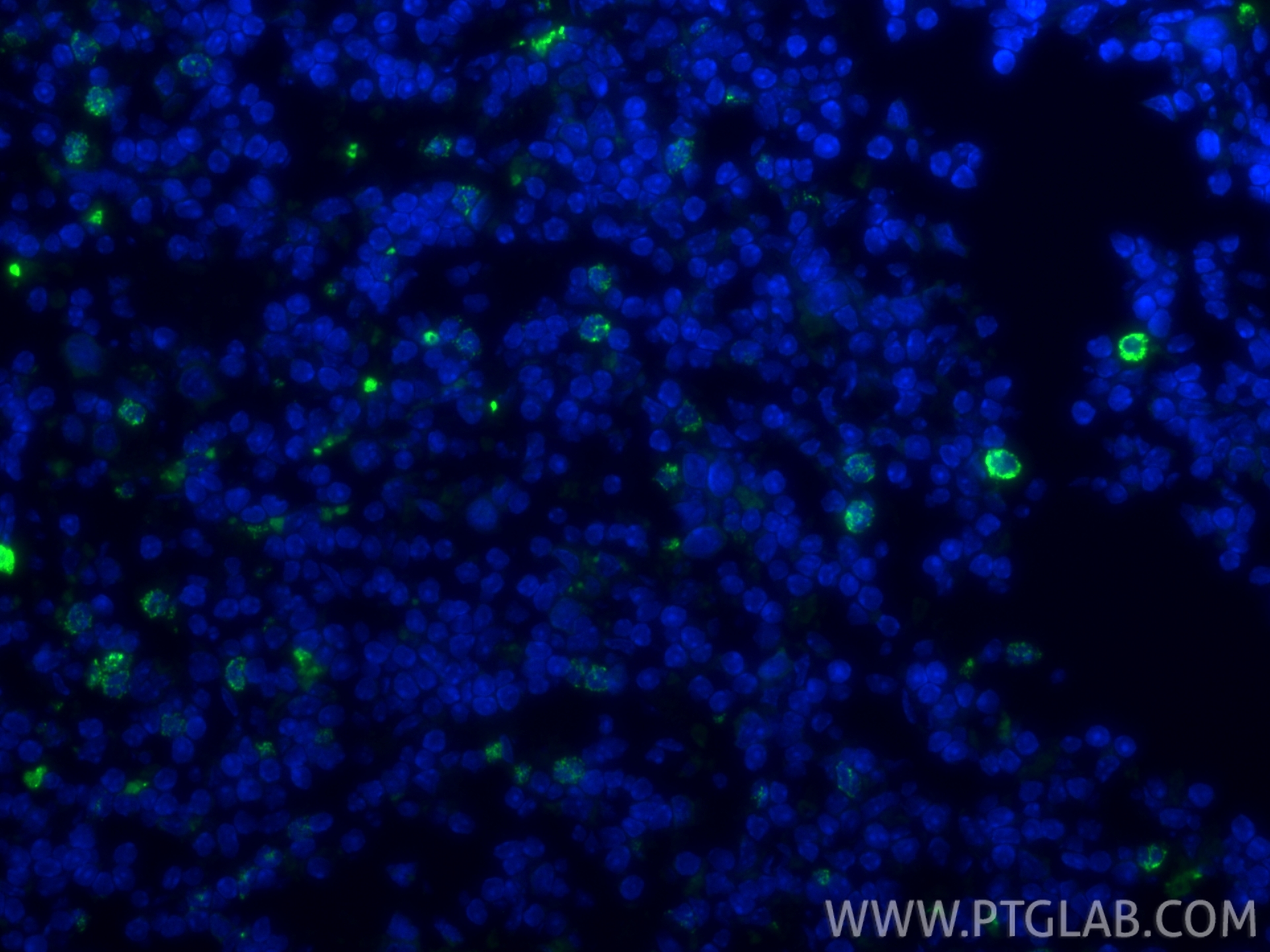 Immunofluorescence (IF) / fluorescent staining of mouse spleen tissue using Biotin-conjugated MPO Polyclonal antibody (Biotin-22225)
