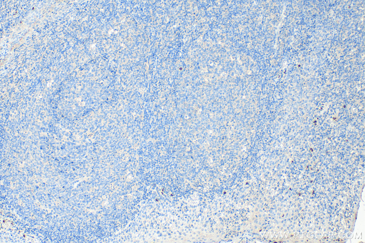 Immunohistochemistry (IHC) staining of human tonsillitis tissue using Biotin-conjugated MPO Monoclonal antibody (Biotin-66177)
