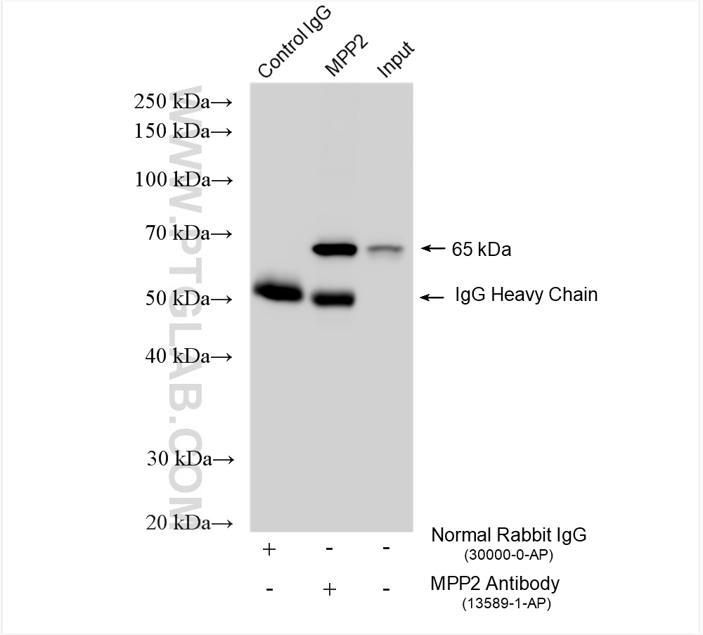 Immunoprecipitation (IP) experiment of mouse eye tissue using MPP2 Polyclonal antibody (13589-1-AP)