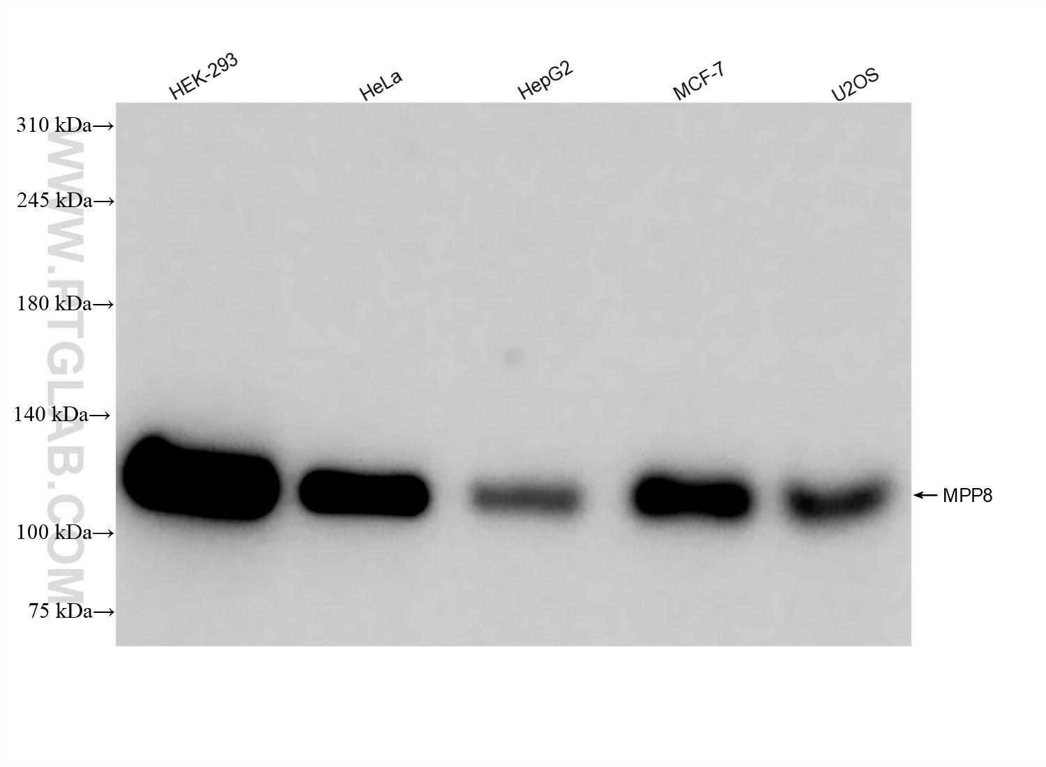 Western Blot (WB) analysis of various lysates using MPP8 Recombinant antibody (84719-4-RR)