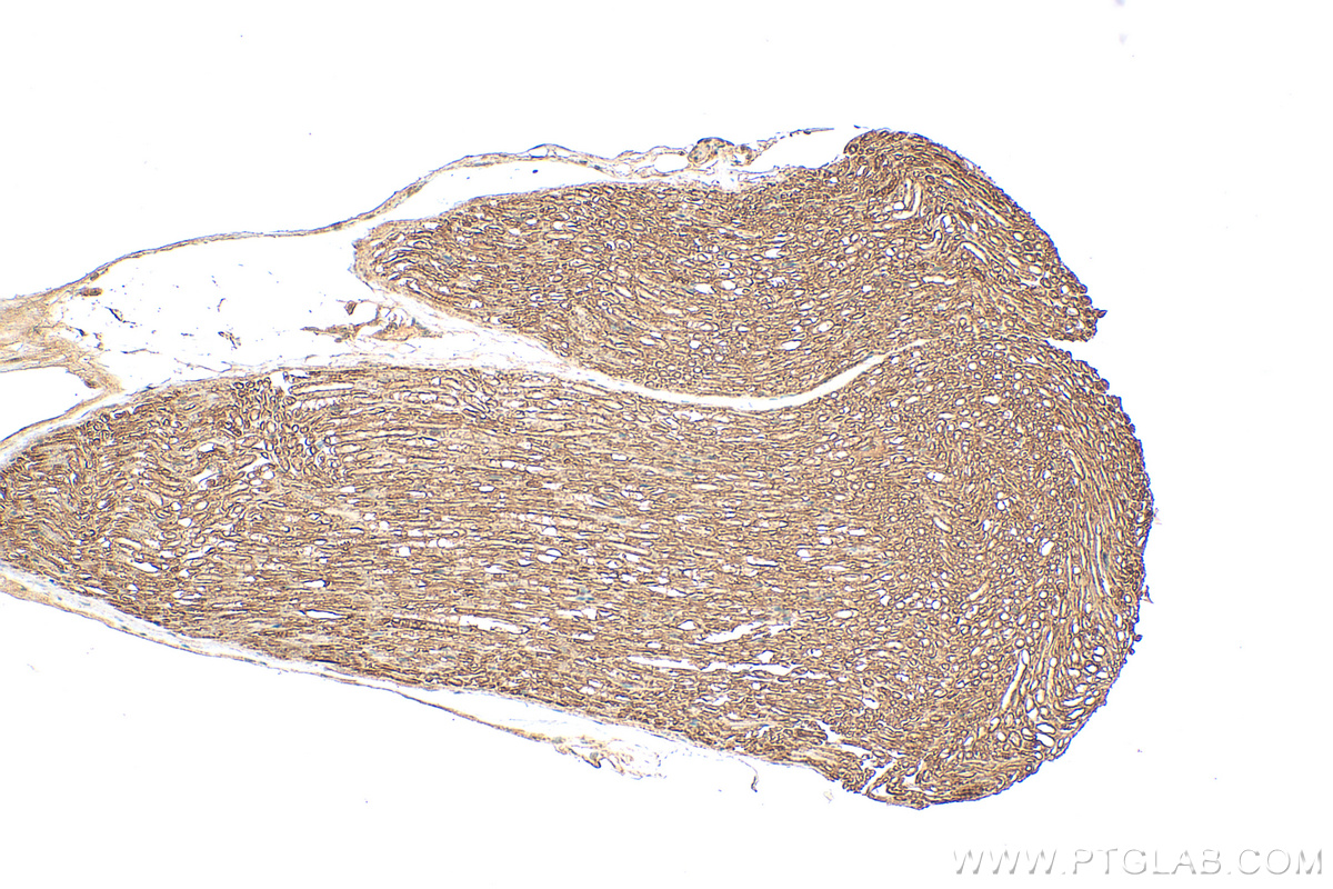 Immunohistochemistry (IHC) staining of mouse Ischiadic nerve tissue using MPZ / P0 Polyclonal antibody (10572-1-AP)