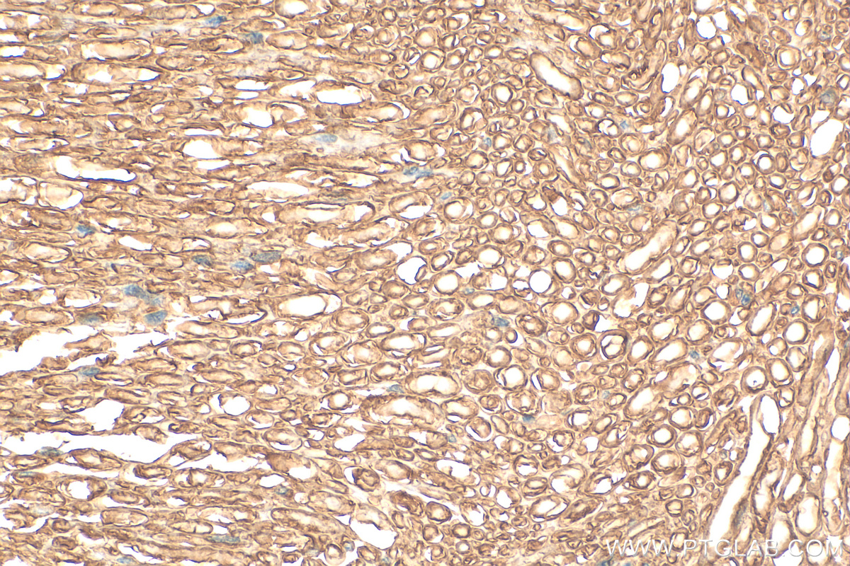 Immunohistochemistry (IHC) staining of mouse Ischiadic nerve tissue using MPZ / P0 Polyclonal antibody (10572-1-AP)