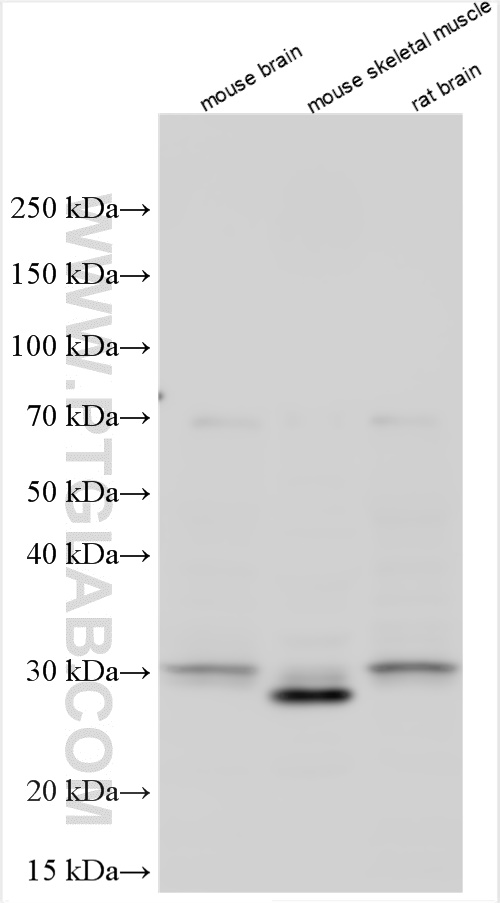Western Blot (WB) analysis of various lysates using MPZ / P0 Polyclonal antibody (10572-1-AP)