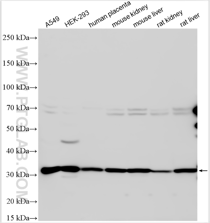 Western Blot (WB) analysis of various lysates using MPZL1 Polyclonal antibody (29784-1-AP)
