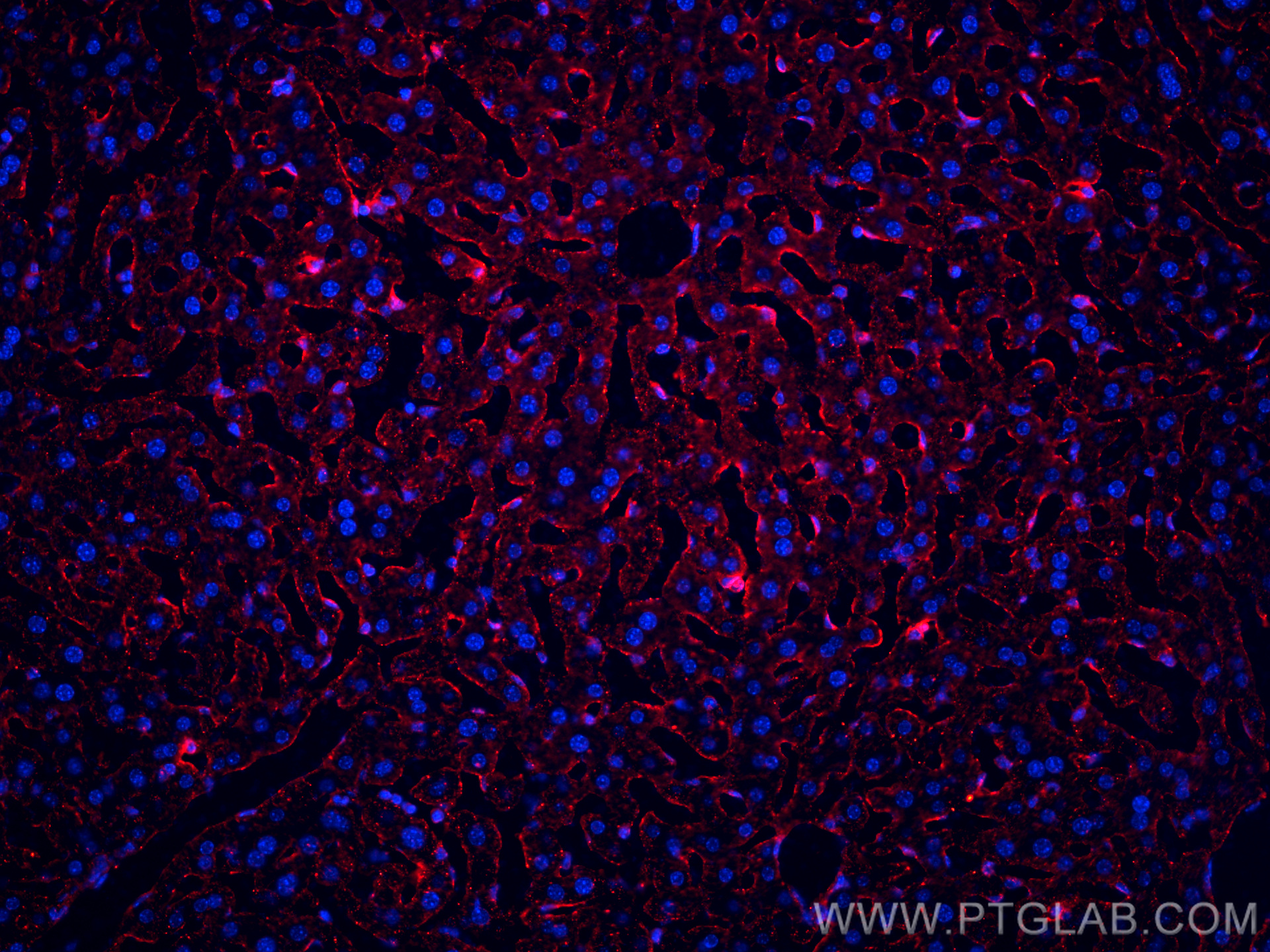 Immunofluorescence (IF) / fluorescent staining of mouse liver tissue using CD206 Polyclonal antibody (18704-1-AP)