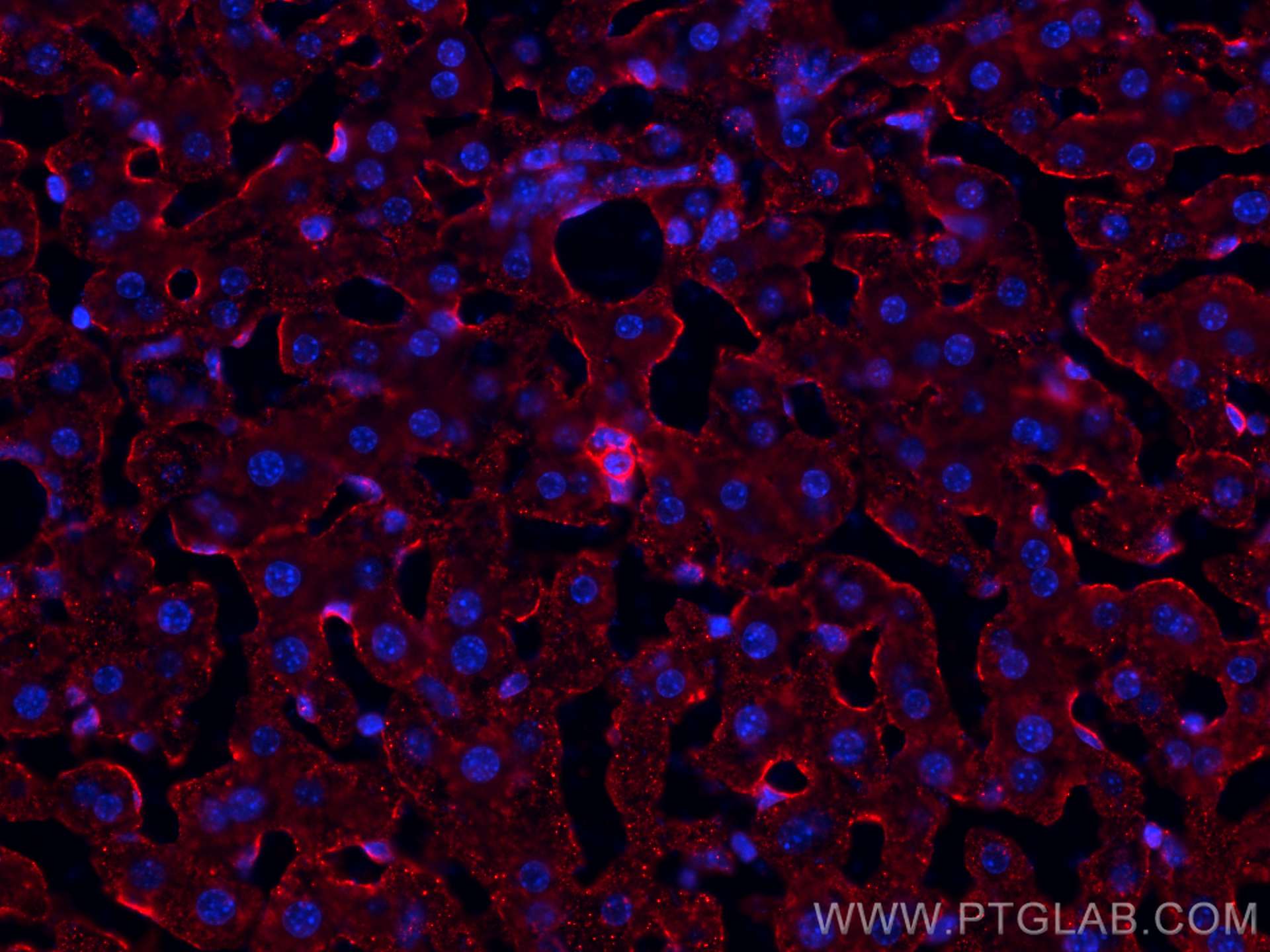 Immunofluorescence (IF) / fluorescent staining of mouse liver tissue using CD206 Polyclonal antibody (18704-1-AP)