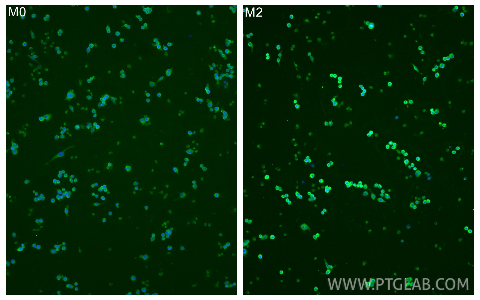 Immunofluorescence (IF) / fluorescent staining of RAW 264.7 cells using CD206 Polyclonal antibody (18704-1-AP)