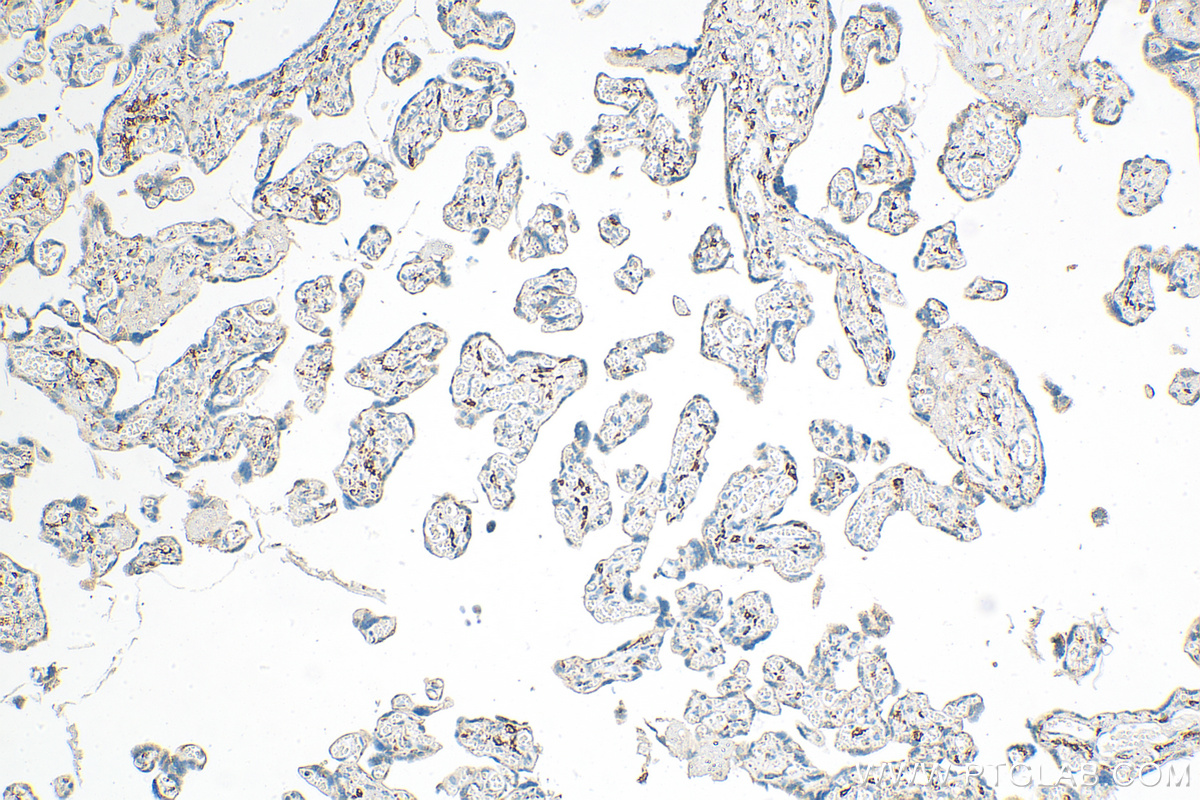 Immunohistochemistry (IHC) staining of human placenta tissue using CD206 Polyclonal antibody (18704-1-AP)