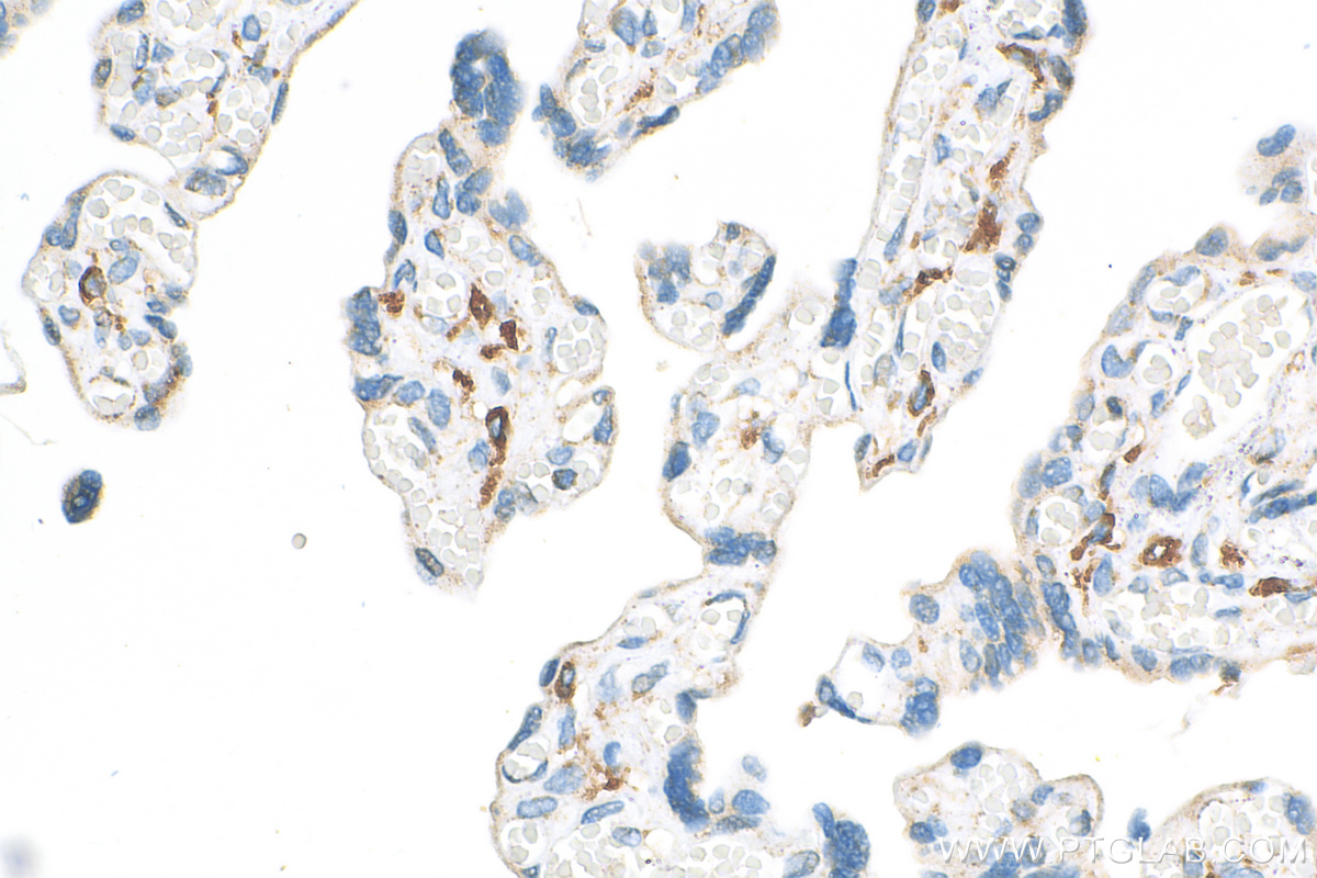 Immunohistochemistry (IHC) staining of human placenta tissue using CD206 Polyclonal antibody (18704-1-AP)