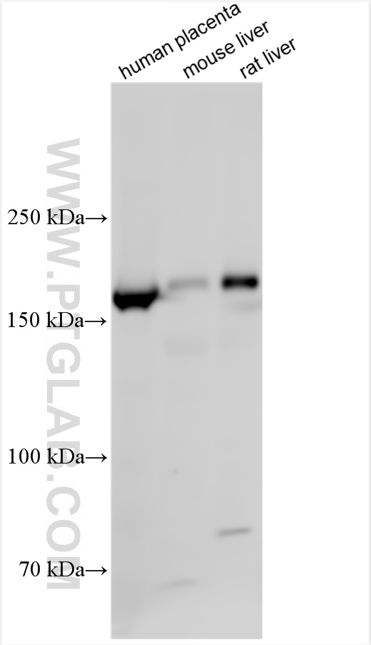 Western Blot (WB) analysis of various lysates using CD206 Polyclonal antibody (18704-1-AP)