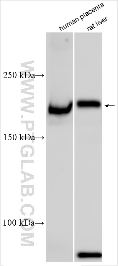 Western Blot (WB) analysis of various lysates using CD206 Polyclonal antibody (18704-1-AP)