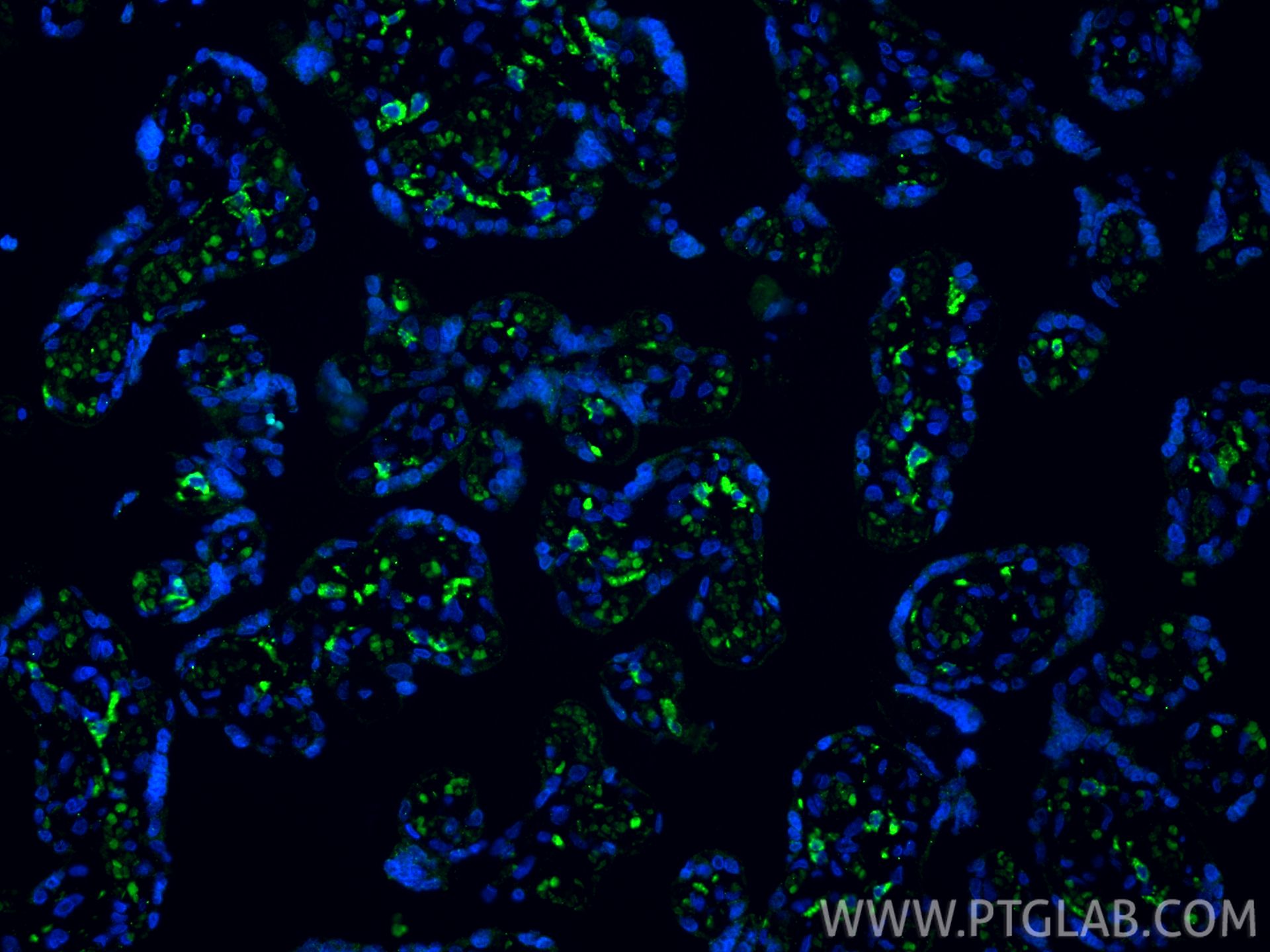 Immunofluorescence (IF) / fluorescent staining of human placenta tissue using CD206 Monoclonal antibody (60143-1-Ig)