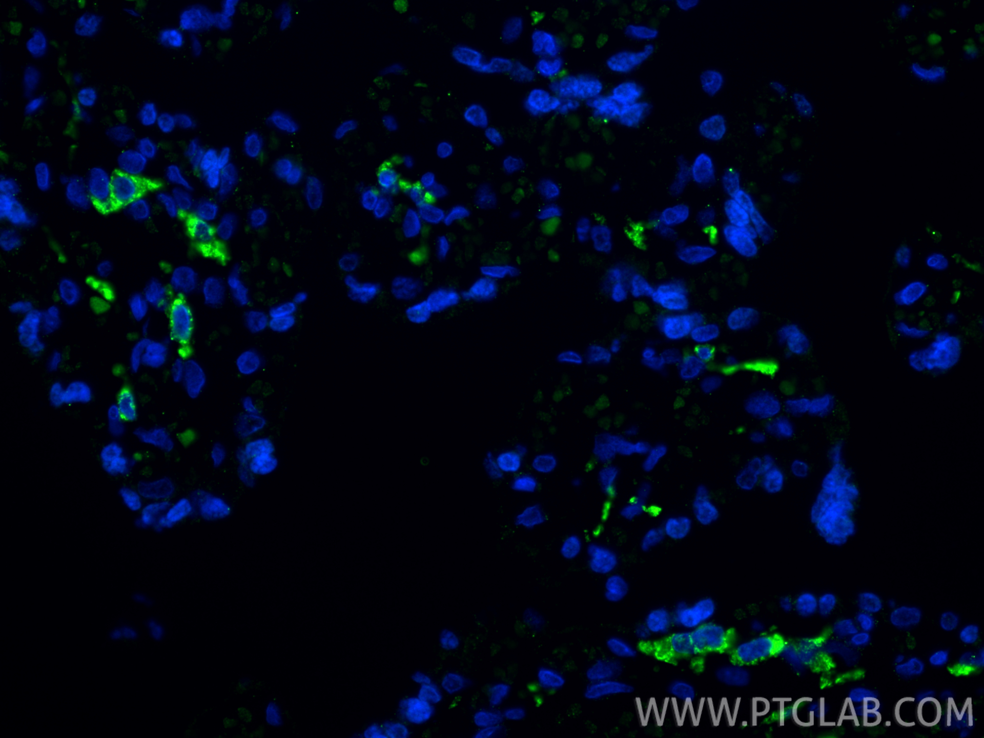 Immunofluorescence (IF) / fluorescent staining of human placenta tissue using CD206 Monoclonal antibody (60143-1-Ig)