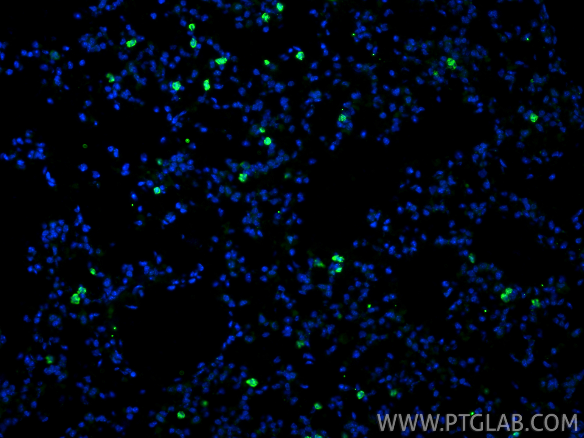 Immunofluorescence (IF) / fluorescent staining of mouse lung tissue using CD206 Monoclonal antibody (60143-1-Ig)