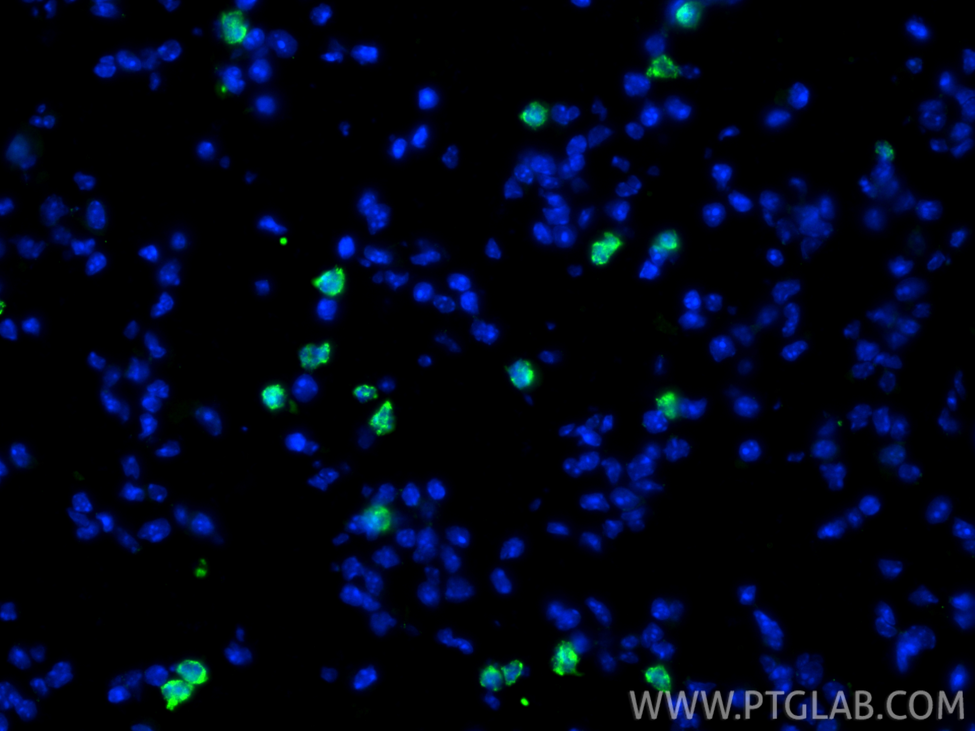 Immunofluorescence (IF) / fluorescent staining of mouse lung tissue using CD206 Monoclonal antibody (60143-1-Ig)