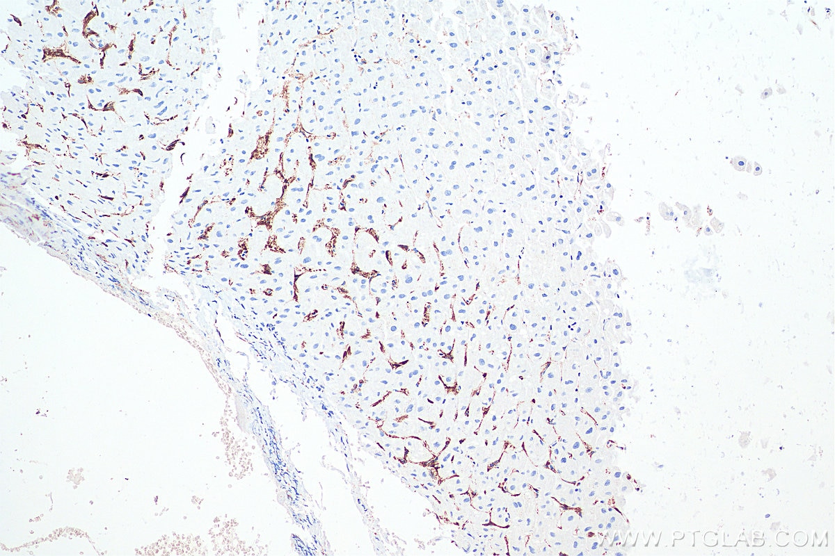 Immunohistochemistry (IHC) staining of human liver tissue using CD206 Monoclonal antibody (60143-1-Ig)