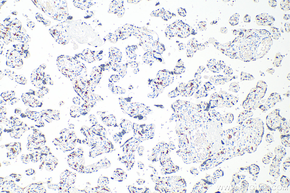 Immunohistochemistry (IHC) staining of human placenta tissue using CD206 Monoclonal antibody (60143-1-Ig)