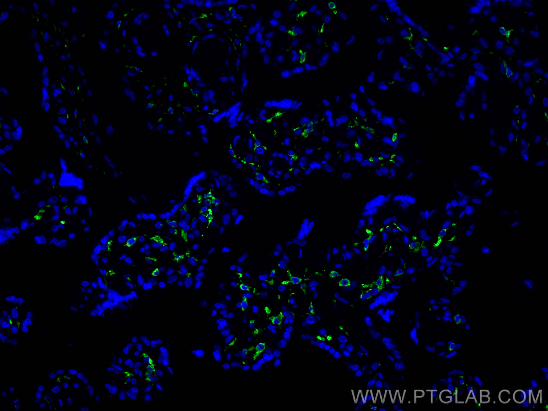 Immunofluorescence (IF) / fluorescent staining of human placenta tissue using CD206 Recombinant antibody (81525-1-RR)