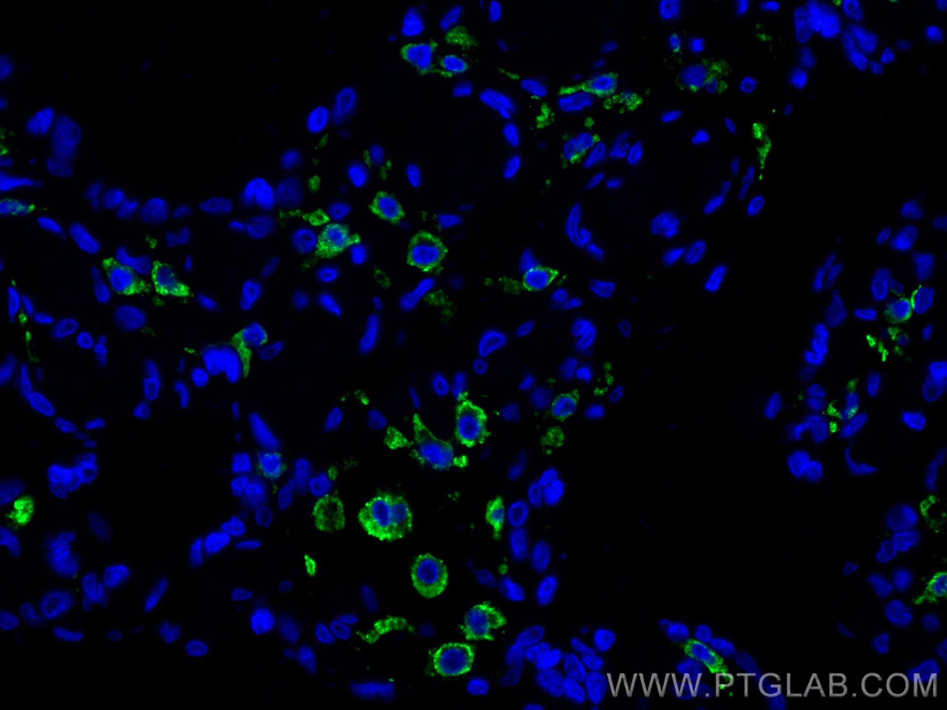 Immunofluorescence (IF) / fluorescent staining of human placenta tissue using CD206 Recombinant antibody (81525-1-RR)