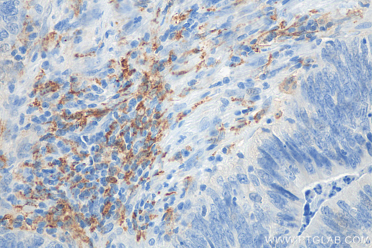 CD206 antibody (81525-1-RR) | Proteintech