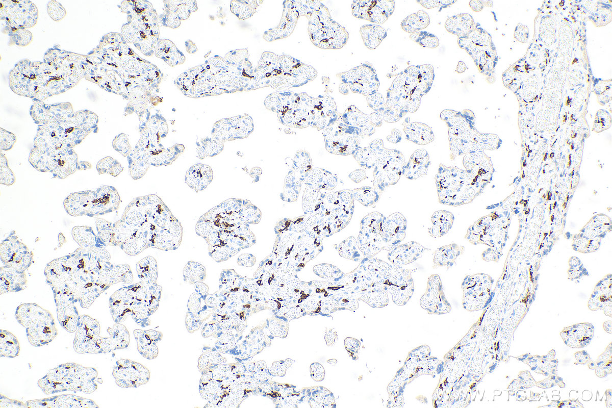 Immunohistochemistry (IHC) staining of human placenta tissue using CD206 Recombinant antibody (81525-1-RR)